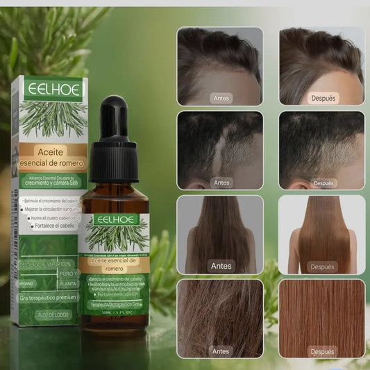 Aceite De Romero Natural para el Crecimiento De Cabello